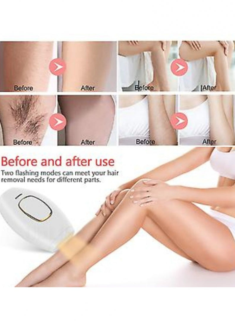 IPL Hair Removal by ZapBare™